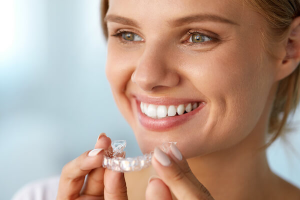 Retencia pri systéme Invisalign